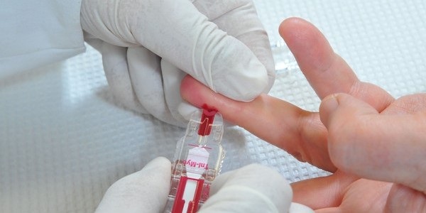 Непереносимість лактози: молоко без лактози, продукти, що містять лактозу » журнал здоров'я iHealth 3